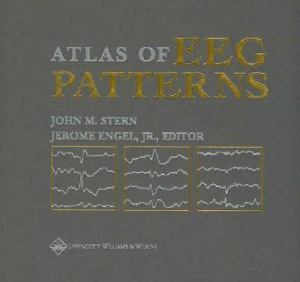 Atlas of EEG Patterns | College of Lake County Bookstore